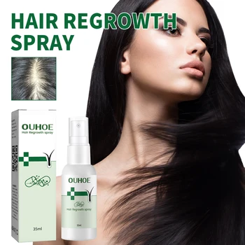 35 мл спрея для роста волос Восстанавливает поврежденные волосяные фолликулы, сухие и вьющиеся волосы, густой спрей для волос против выпадения