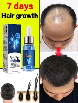 Быстрый рост волос Масло для роста волос Эффективное Лечение облысения Наследственное выпадение волос Послеродовое выпадение Волос Себорейное Средство против выпадения волос