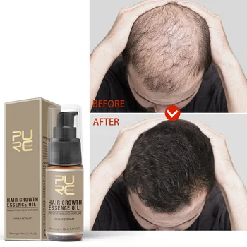 Имбирные средства для роста волос, быстрорастущий спрей для кожи головы, масло для ухода за волосами Beauty Health для мужчин и женщин, 30 мл